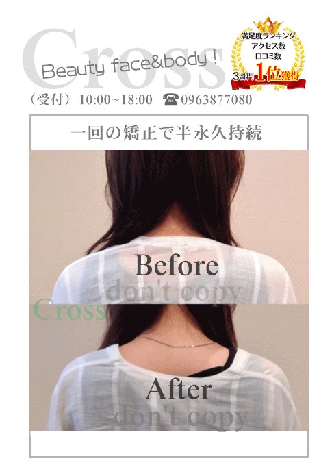 肩幅矯正 肩幅矯正