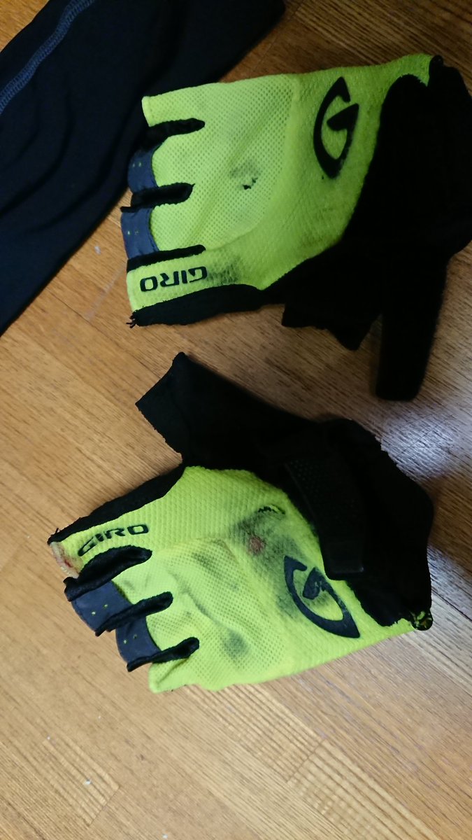 mt_moiwa's tweet photo. あと、暑いからとか日焼けあとがいやとかでグローブしないのもおすすめできません、できれば指抜きじゃないほうがいいです。自分今回事故って左手人指し指の爪が剥がれました😫🚑 https://t.co/DPhUjntNpA