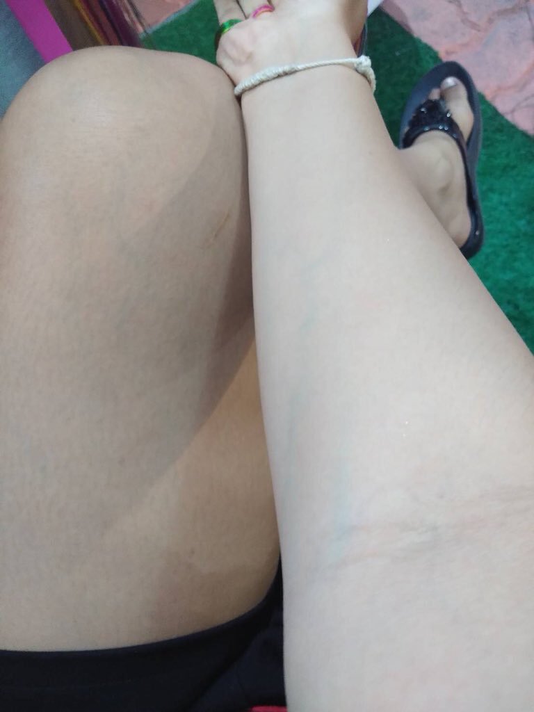 Mananya85293992's tweet image. อะ!!!  เห็นผลมั้ยดูเอา กินแค่#dwcollagen + #grapeseed เปลี่ยนดำเป็นผิวขาว เอาดิ เอาดิ เอาดิ ขอท้าให้กินโว้ยยยย   #O2soSTRONG