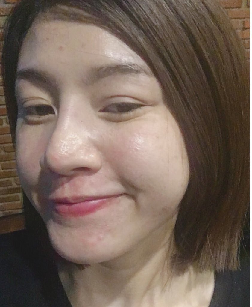 Mananya85293992's tweet image. ของจริงโว้ยยยย กิน#dwcollagen ไปเดือนเดียวจริงๆ  ประมาณ4 กล่อง  คือแบบ สิวอักเสบยุบ รอบสิวจาง  หน้าเนียนขึ้น แบบเนียนละเอียด  คือสิวหายไปเยอะมากๆ อันนี้ปลื้มมากจริงๆ  อยากเอามาแชร์ให้คนเป็นสิวคะ  ไปหาซื้อมาทานนะคะ  ชื่อว่า dwcollagen หน้ากล่องรูปแอปเปิ้ลสีแดงคะ   #O2soSTRONG