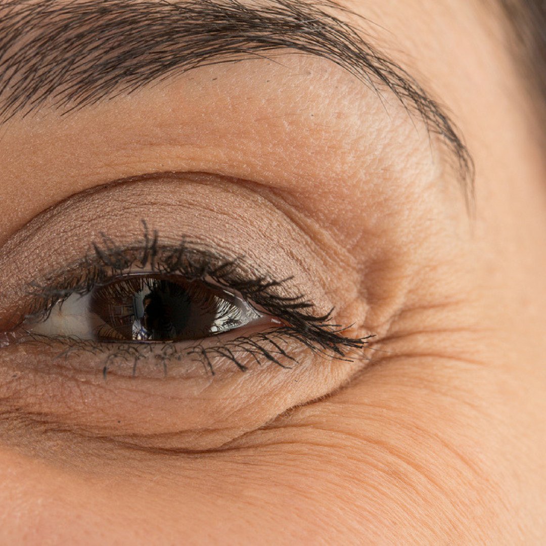 Eye area. Морщины под глазами масла. Eye area.
