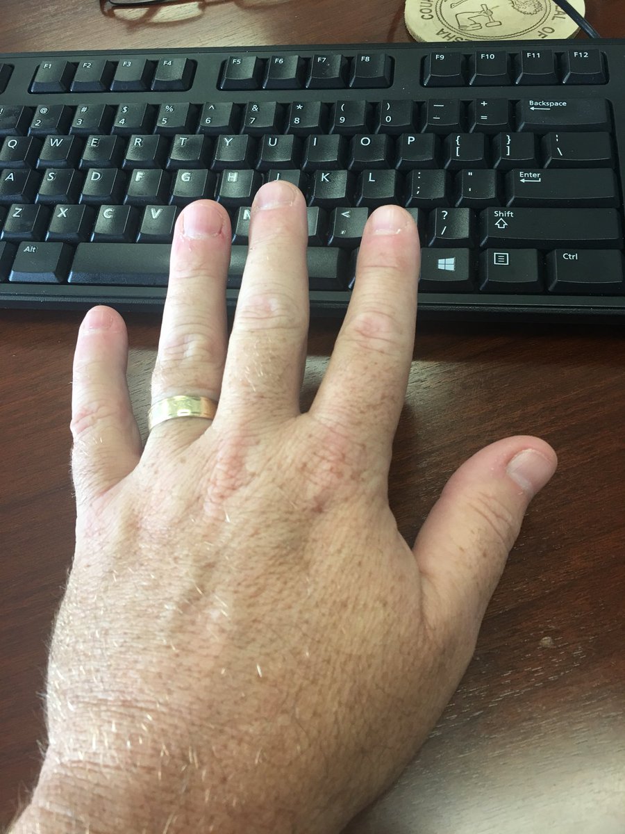 It’s <a href="/lefthandersday/">lefthandersday</a>. Who out there joins me in southpaw pride?