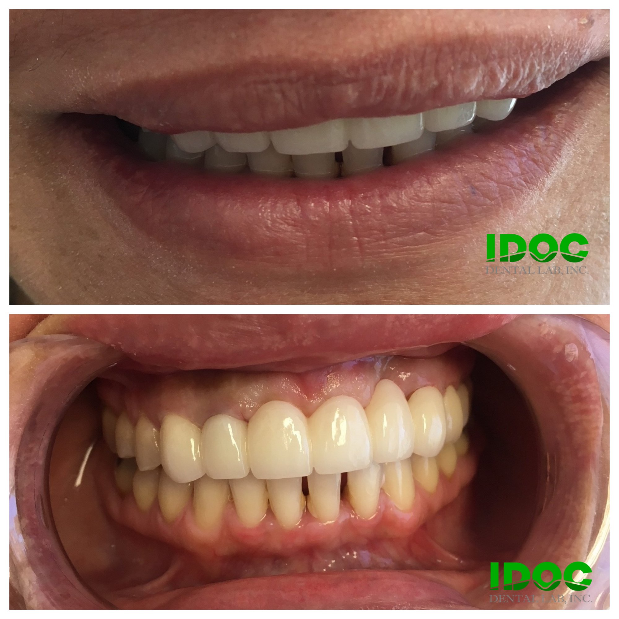 IDOC Dental Lab (IDOCdentalLab) / Twitter