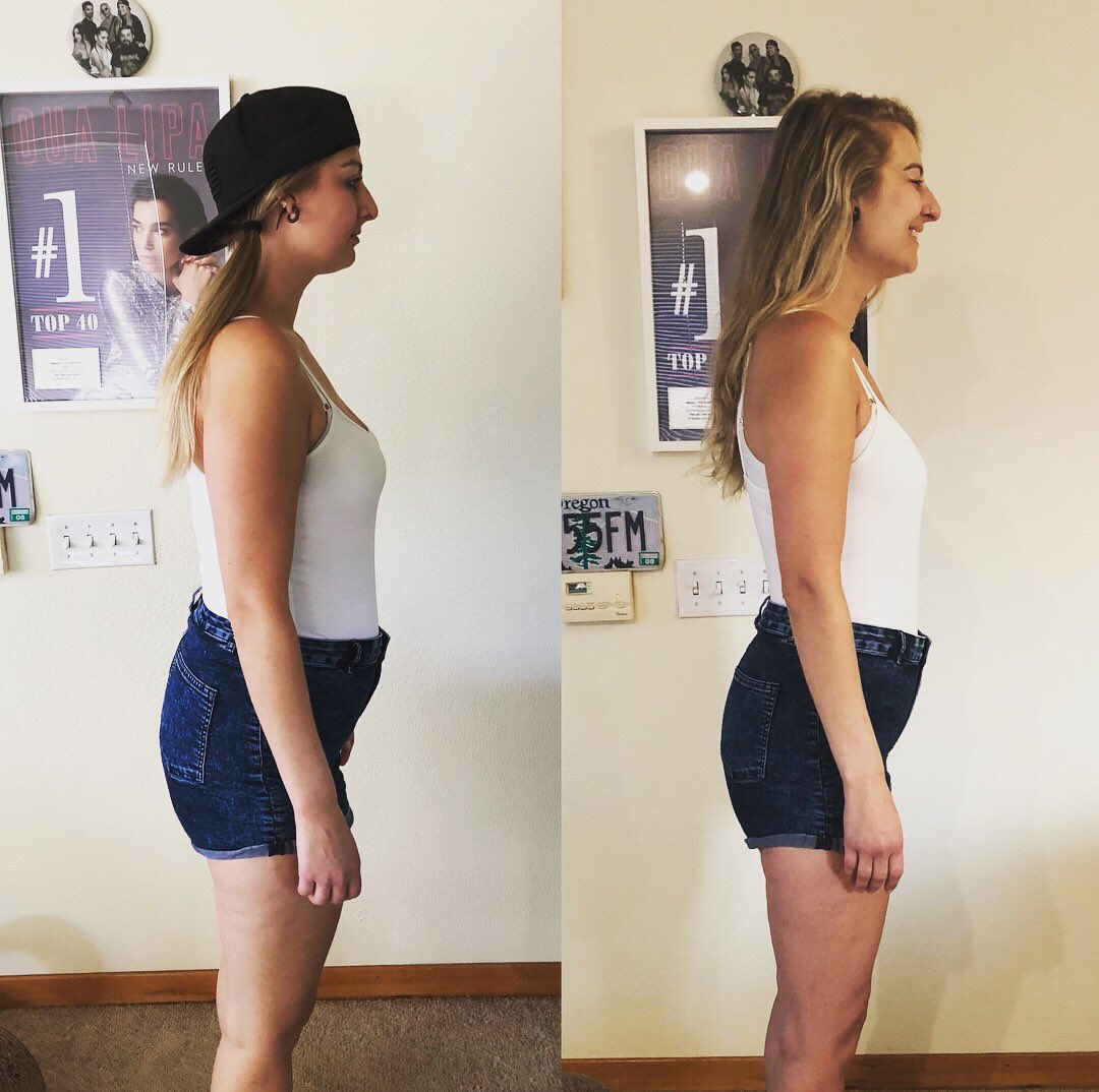 dudeitsice's tweet photo. It was definitely a challenging journey for myself and @itsmehuggie, but I couldnβt be happier about the weight loss we achieved on the @slimme1 #YP10 program. I set a goal to lose 21 pounds and what did I lose? 22 pounds, baby! Now to maintain.. ππΌ https://t.co/tMiPTneqIy