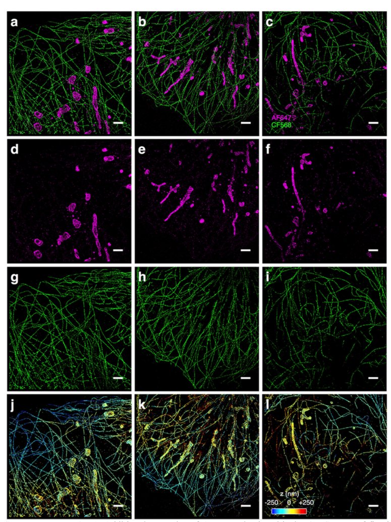 mmw_lmw's tweet image. #Single_Molecule_Localization_Microscopy | Data-Driven #Artificial_Neural_Networks enhance Positioning | Ke Xu @UCBerkeley @biorxivpreprint buff.ly/2vD9vf2117
