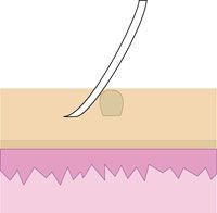 tagbanduk's tweet photo. Are you suffering from skin tags and have no time for surgical #treatments, then @tagband is the best treatment for you. It is a #safe and easy to use device.
Apply tagband and get rid of #skintag to a beautiful clear skin. https://t.co/4IkfAXA4Ak
#ClearSkinTwitter #skincare https://t.co/c2GvXfHB31