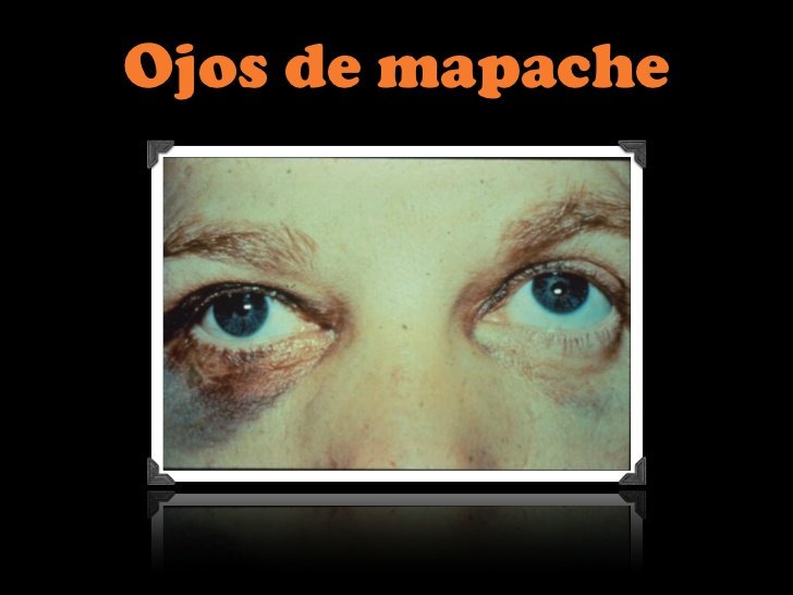 Mechanical Epistemology and Mixed Mathematics: Descartes’s Problems