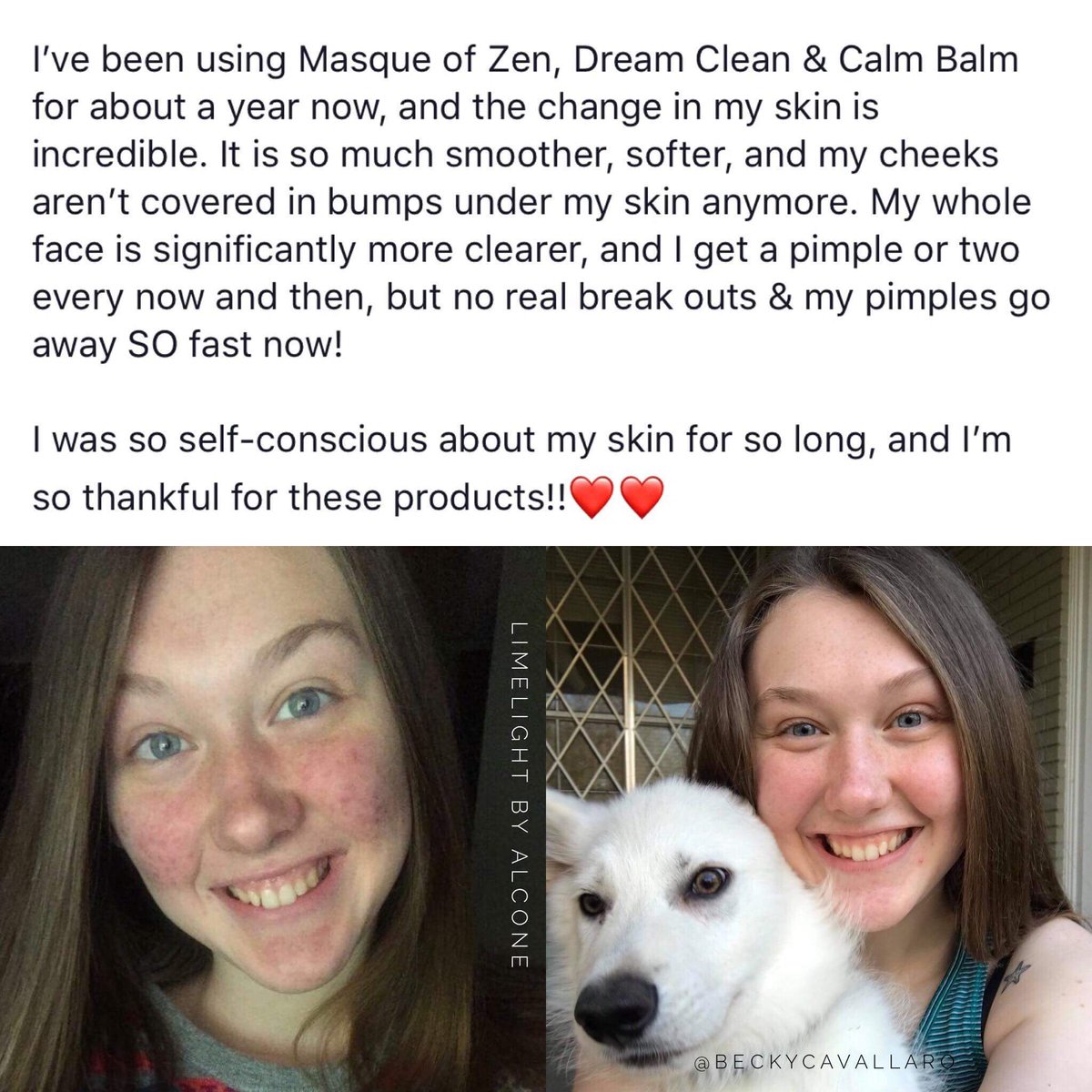 Sassyxo2's tweet image. How great skin can improve your confidence 

limelifebyalcone.com/missyvee/party…