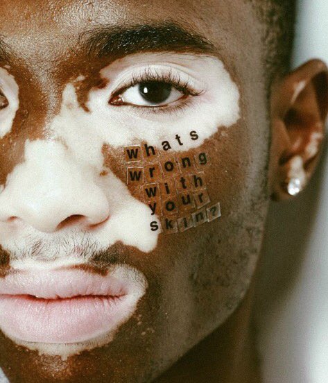 AleroJasmine's tweet image. Skin