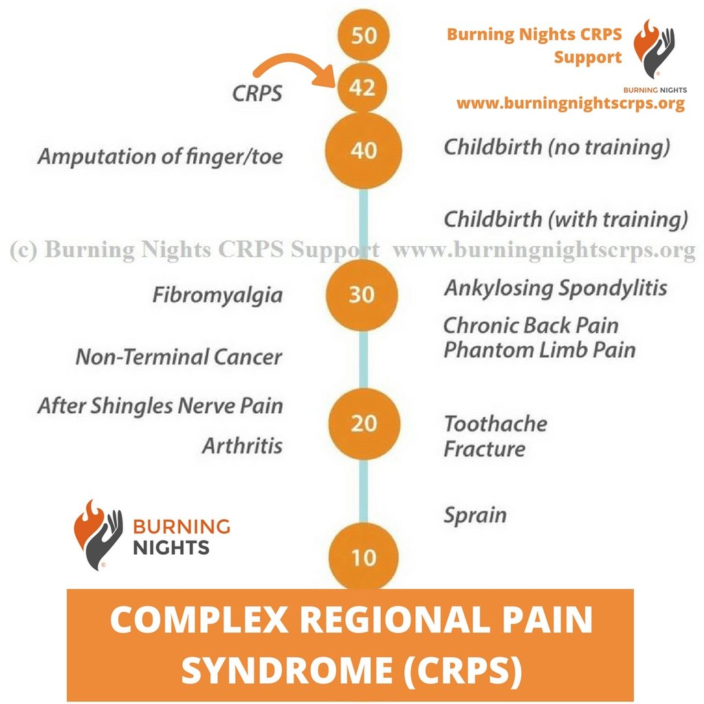 Rsd Pain Chart