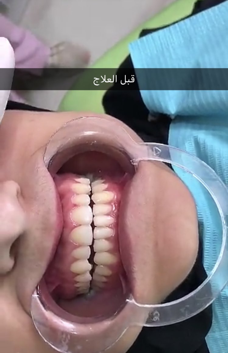 طاقتني الضيقة ، جريمة بشعة بحق المهنة 💔