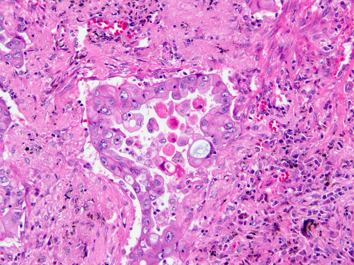 view die verteilung des lichtes in den kugelförmigen sternhaufen m 5 m 15 und m 92