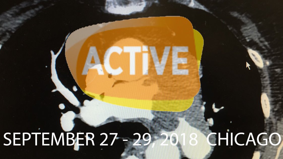 jameshorowitzmd's tweet photo. WANT TO HAVE YOUR ๐คฏ?
Check out #ACTiVE18 for everything #PE #DVT #VTE #PERT #filterOUT in Chicago๐ 9/27-9/29/18!
Discounted rates through 8/31 at https://t.co/Z0DnGIGpgE
Faculty include @rkryu @kush_r_desai @akhileshsistaMD @rustyhofmannMD @JonnyMoriarty @jameshorowitzmd https://t.co/PcEqbRuSHq