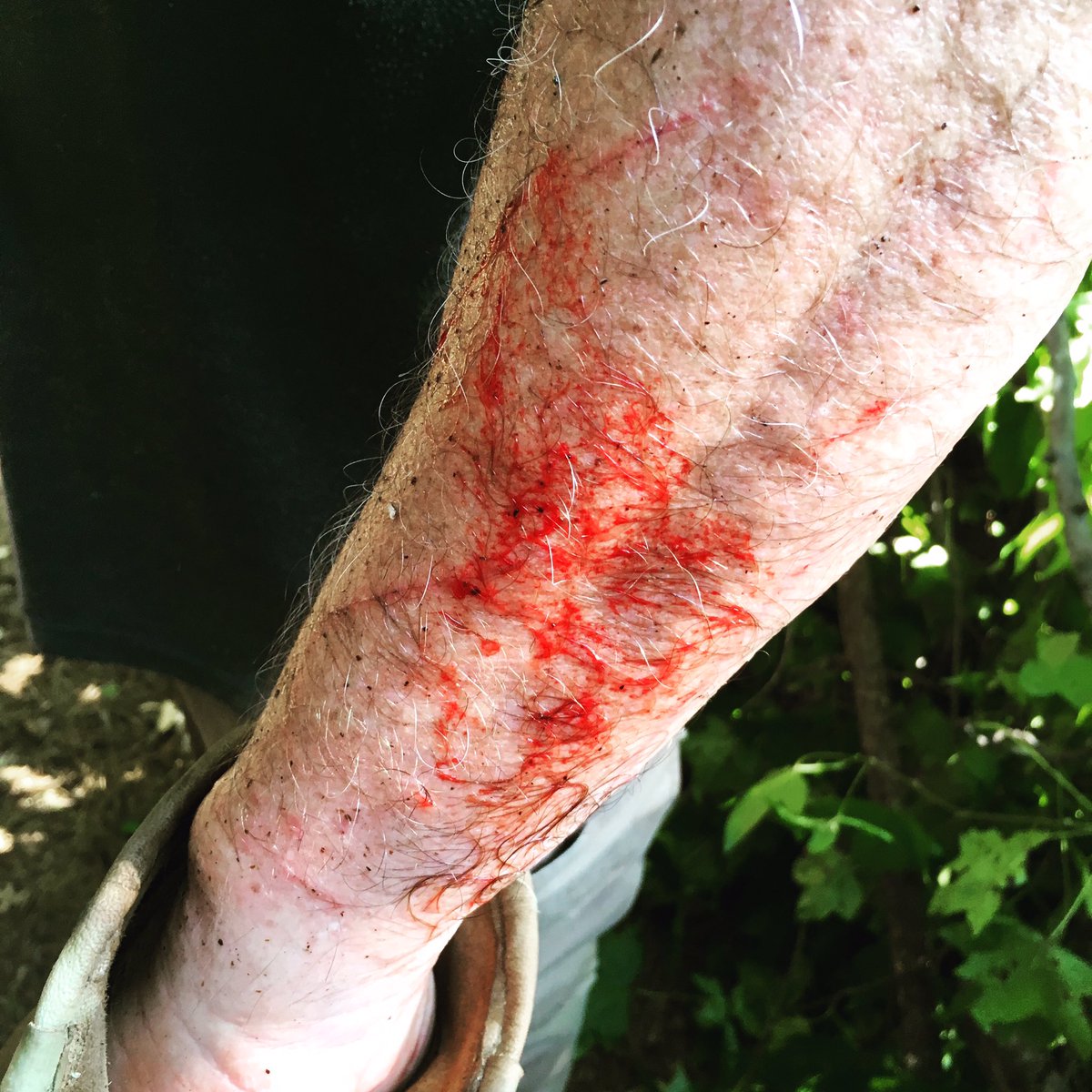 ForestToFarm's tweet image. Briars can be quite nasty! #FarmLife #homesteading