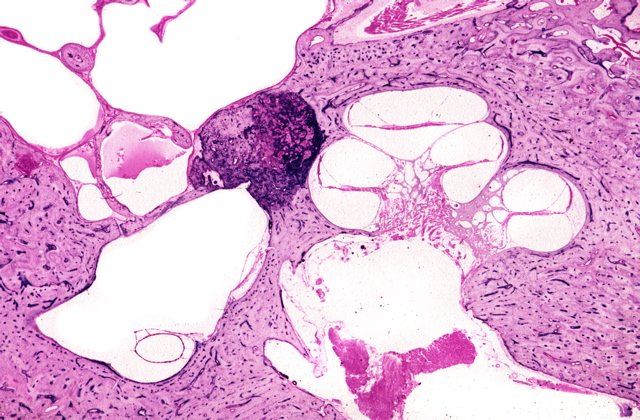 @ASHNRSociety @raddoc12 @rhwiggins @beccacornel @DShatzkes @CDP_Rad @nakoontz @cmtomblinson @LNLedbetter @kevinhsumd @RadRupa No cartoon. Just a plug for otopathologylaboratory.org from @MassEyeAndEar as an outstanding educational resource for trainees interested in the #temporalbone. Check it out!