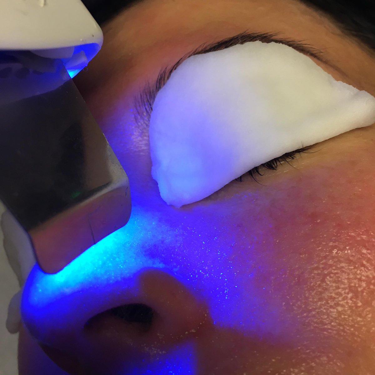 #Ultrasonic peel facial for all skin types available at #theworkssalon. It's the most gentle face #cleansing #treatment that can significantly reduce #acne, clean clogged pores &amp; provide deep moisture without harming. 
 #dublin #skin #skincare #beauty #peel #facials #wellness