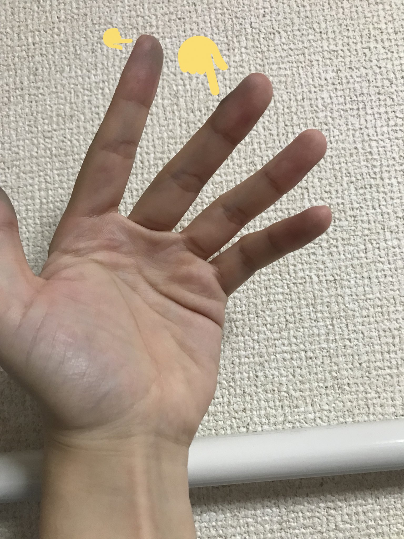 Twitter 上的 烏海 クソ代償に左手の中指に出っ張りが生まれてしまった タコかな あと人差し指の先っちょにもタコが あとサビでやや汚れた T Co L5vfppajsk Twitter Twitter 上的 烏海 クソ代償に左手の中指に出っ張りが生まれてしまった タコかな あと人差し指の先っちょにもタコが あとサビでやや汚れた T Co L5vfppajsk Twitter