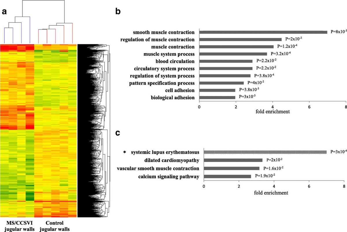 zambo57's tweet photo. Pure innovation in #multiplesclerosis research. There are 924 genes differently expressed in MS jugular walls vs controls. Some reveal #connection with Blood 🧠Barrier #endothelium integrity  ihttps://molmed.biomedcentral.com/articles/10.1186/s10020-018-0043-4 https://t.co/s8Rb65BloG