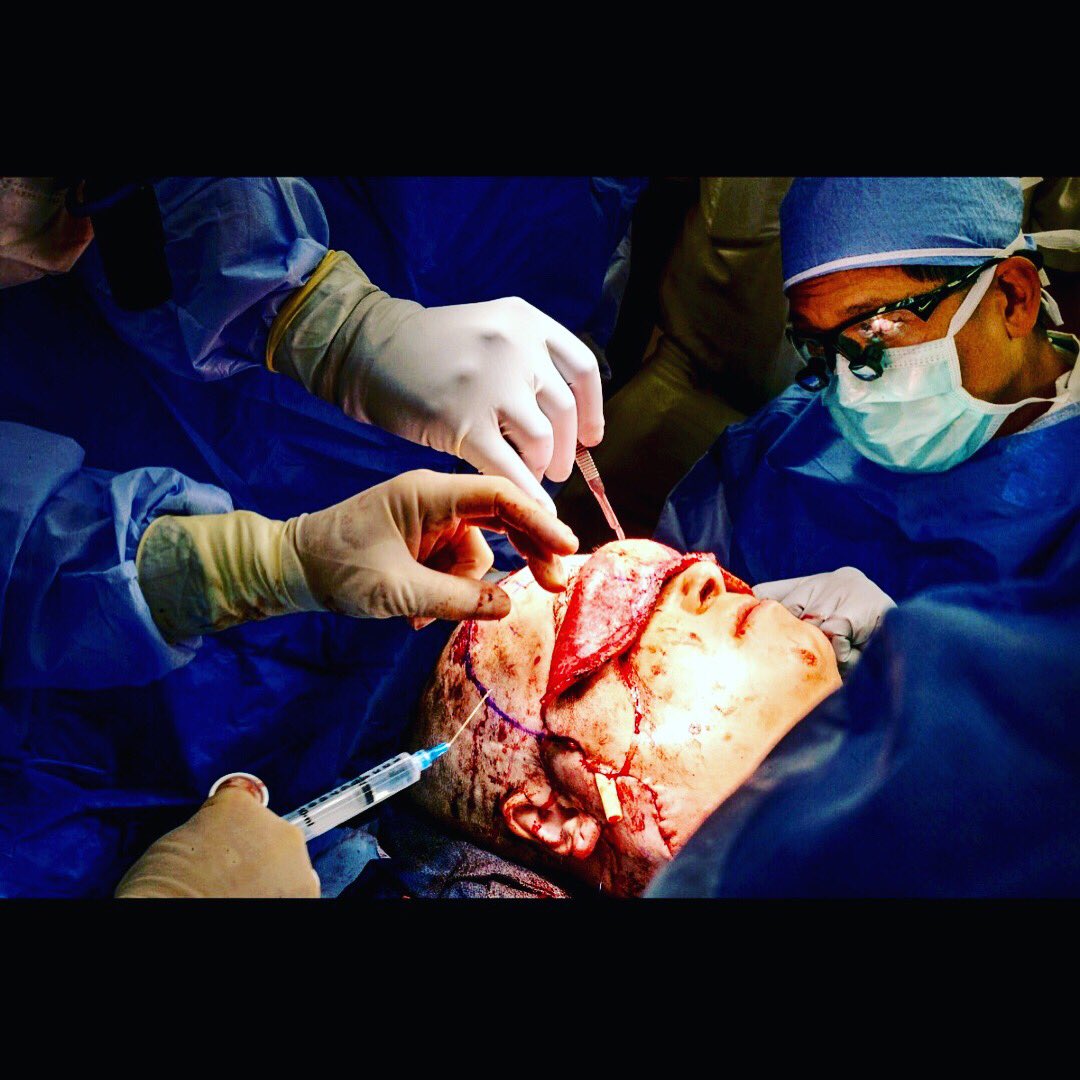 Cleveland Clinic Face Tranplant Team features on National Geographic