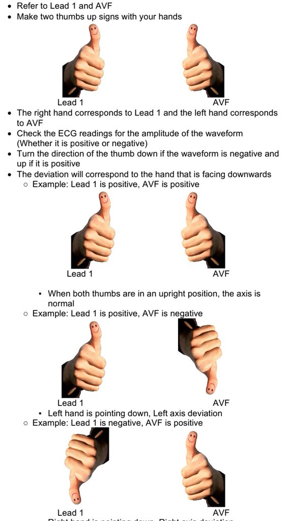 ASMPH2021's tweet photo. [Electrocardiogram Reading]

Regarding Einthoven’s Triangle, due to popular request... https://t.co/dAumr15xKr