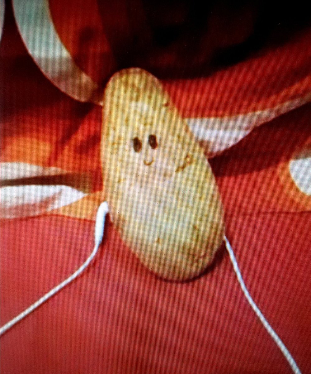 Aşık olduğunuz kişiyle konuşurken böyle görünürsünüz... 😂