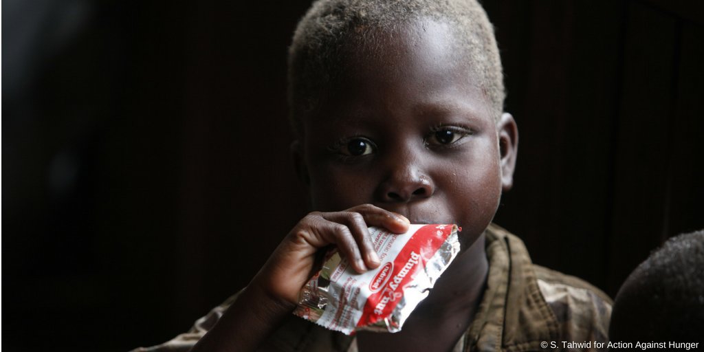 State of Acute Malnutrition tweet media