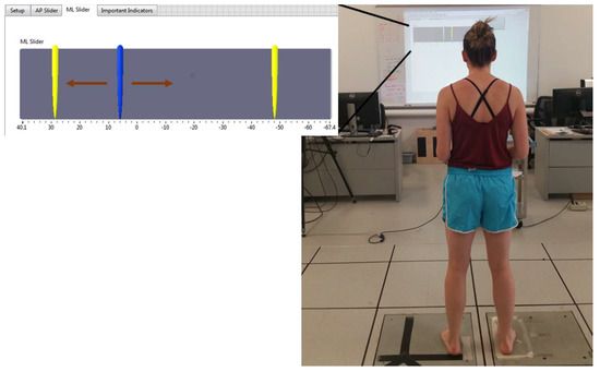 Sensors_MDPI's tweet image. #mdpisensors A Novel and Safe Approach to Simulate Cutting Movements Using Ground Reaction Forces mdpi.com/326414  @Sensors_MDPI by @UDelaware @UNOmaha

#Biomechanics #MovementControl #AnteriorCruciateLigament #Kinetics #Real_TimeFeedback
