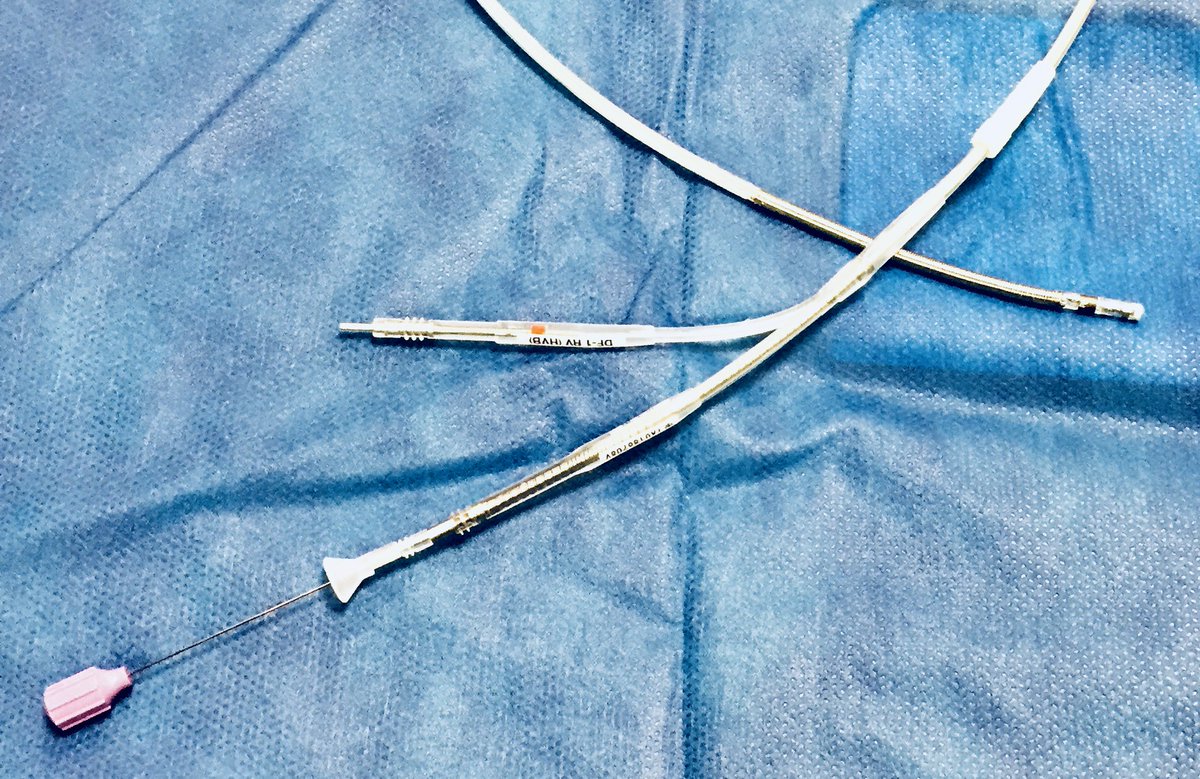 For LBBB-associated idiopathic NICM, the DF-1/IS-1 ICD lead needs to be favored over the DF-4 lead given the ability to easily downgrade if the LVEF normalizes. A DF-4 to IS-1 adapter is still not available. Myocardial recovery data from NEOLITH II coming soon...