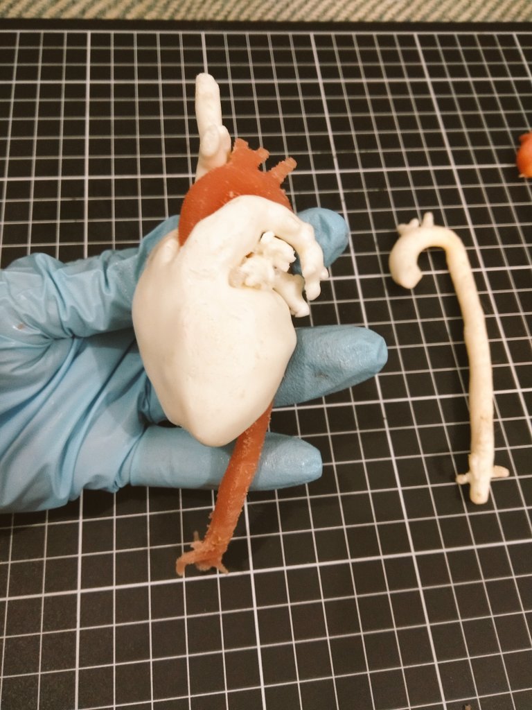 Making some 3d models with different materials. Silicone-based haptic model of aorta.#3Dprinting #Healthcare #3dprinted #3danatomy #3dmodelling #surgery