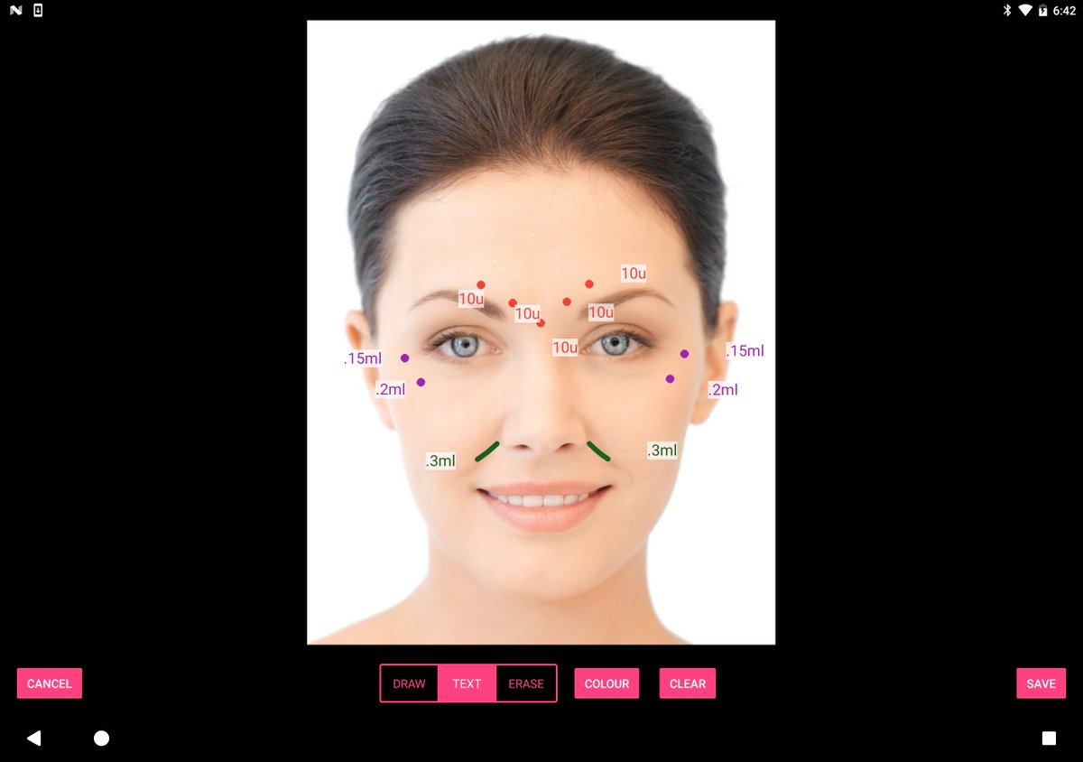 iReviveSoftware's tweet image. One of the many features of iRevive: creating face maps with treatment dots &amp;amp; lines and annotations. #irevive#aesthetics