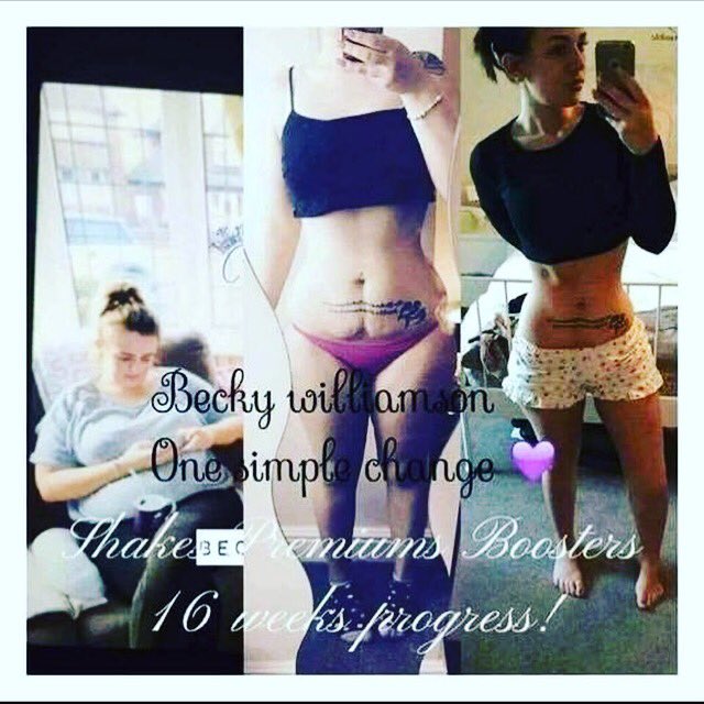 MelaniePett2's tweet photo. Becky ๐ has done AMAZING ๐๐
WAIST GOALS ๐
Any mummies out there? ๐ Want your Prebaby Body Back? ๐
I can HELP YOU ๐
#summershred #thehealthproject https://t.co/c9288QGty4