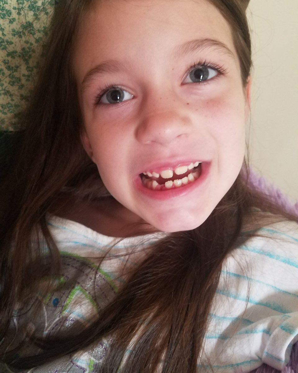 katie18xox's tweet image. another one lost #losttooth