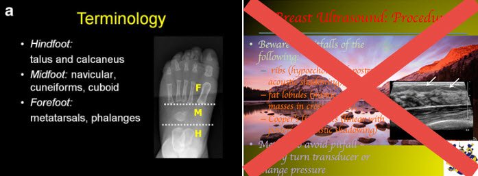 PedRadJournal's tweet photo. September eTOC:
Minsymposium on #education in #radiology
Teach in the modern era, teach to #mellennials & wake up your lecture!
Effect of iodinated contrast on thyroid fxn.
Can DWI replace IV #gadolinium for #MR #enterography for #IBD ?
and more!
https://t.co/39SMhYTW15
#PedsRad https://t.co/JdcXBPIfQq