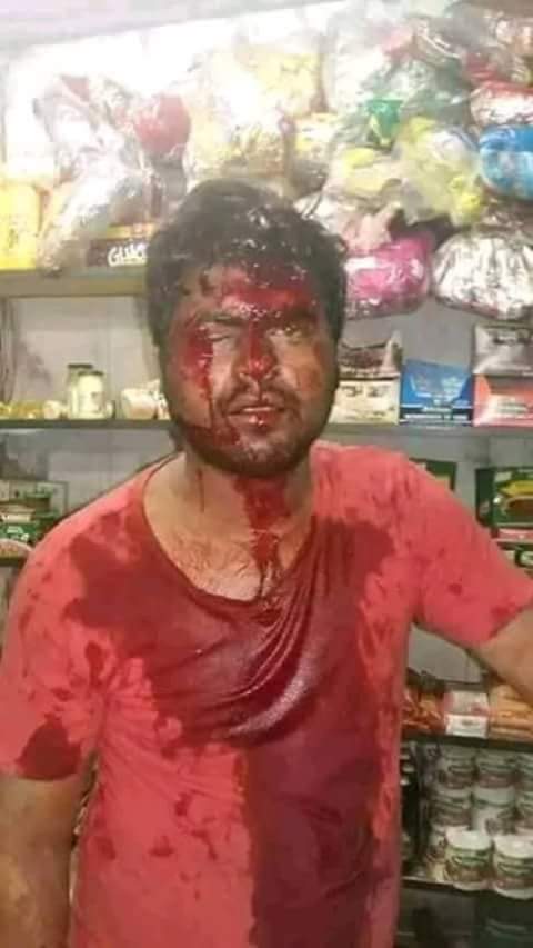 I_Am_TheLes's tweet photo. Yes they sell us fake or expired goods but do they deserve this? 

Is there a better way to deal with this situation? When are we going to learn violence solves nothing but creates more problems? https://t.co/QjAPnaTDCM