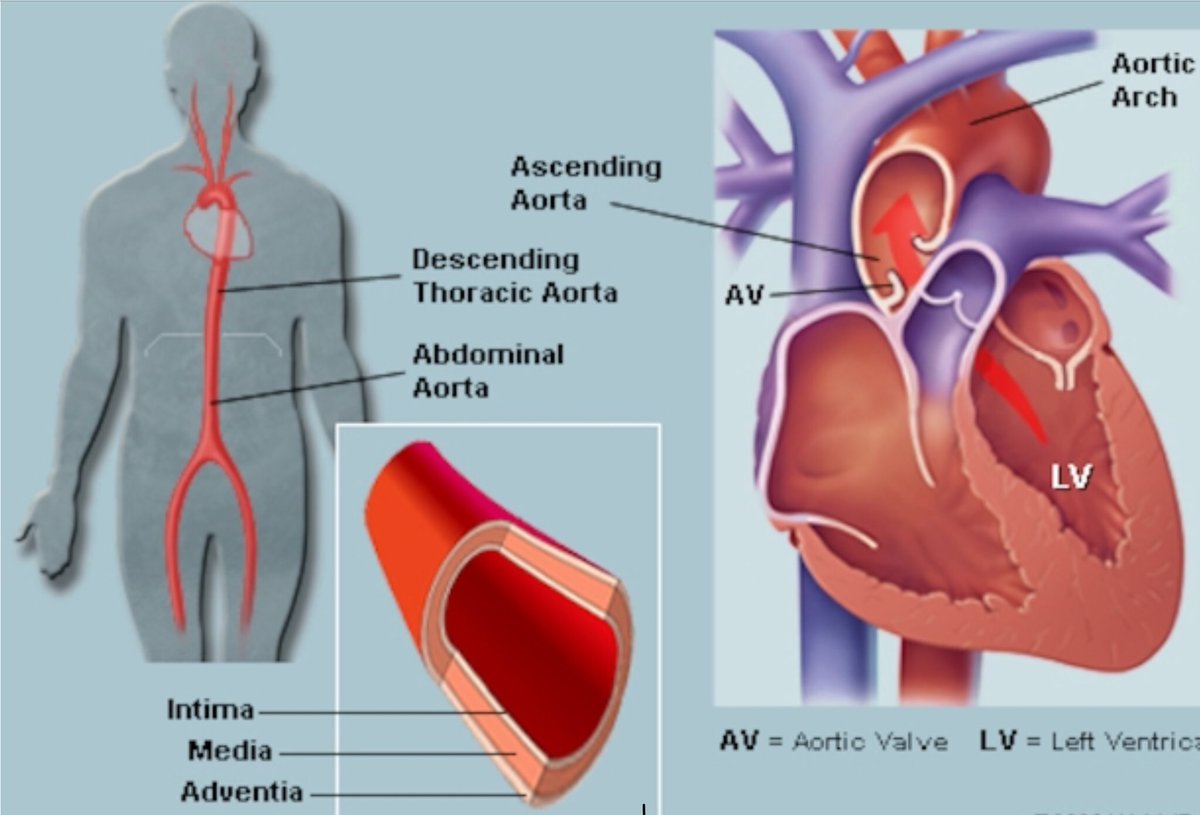aort anevrizması hipertansiyon)