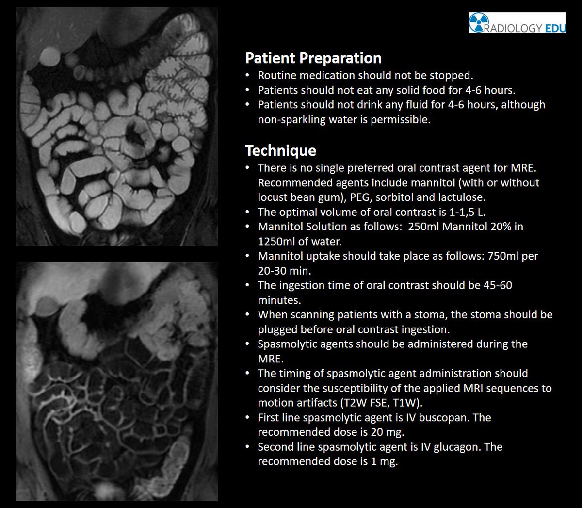 MRE patient preparation and technique.
More information about MR Protocol and slice positioning here: myradiologyedu.com/body-positioni…
#radiologyedu #myradiologyedu #radiologyeducation #myradiologyeducation #radiology #MRI #MRE #enterography #smallbowel #Radiographer #MRI_Technologist