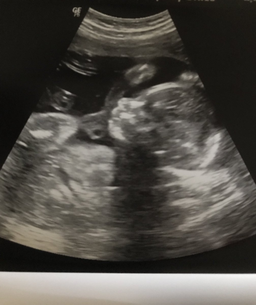 amichaelswx's tweet photo. Have you been wondering about Baby Michaels’ gender? Well for those who have been curious, I decided to finally get a move on it, and planned a little something to reveal it. You can catch it near the end of the 6am show and the end of 8am show on @fox43 Morning News! https://t.co/RaEb1WA2uM
