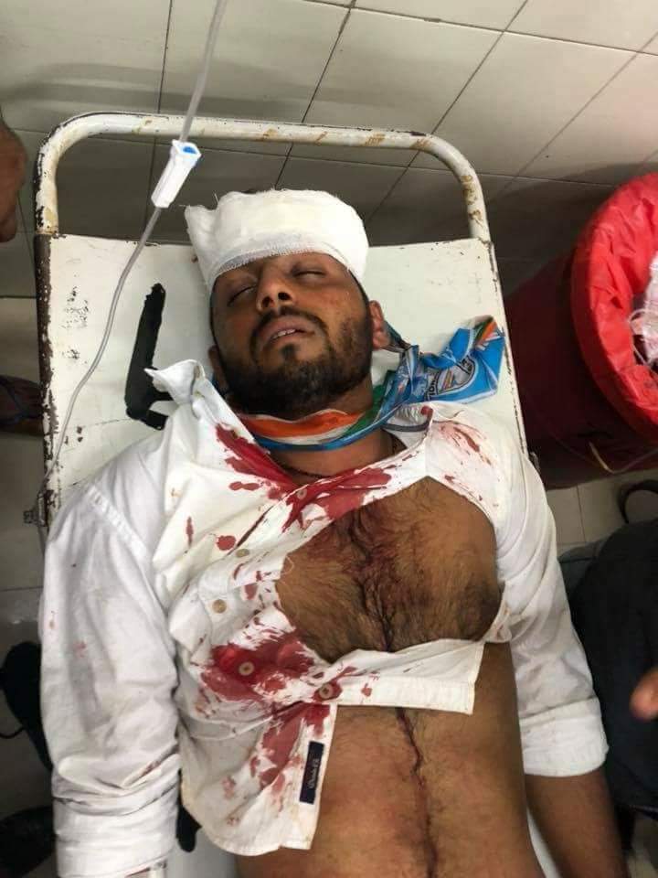 Sourabhmandloi7's tweet photo. NSUI राजस्थान के प्प्रदेशाध्यक्ष अभिमन्यू पूनिया और राजस्थान विश्वविद्यालय छात्रसंघ अध्यक्ष् प्रत्याक्षी रणवीर सिंघानिया पर बोखलाए हुये विरोधियो द्वारा गत रात हमला करना निंदनीय कृत्य है इसका जवाब राजस्थान विश्वविद्यालय का छात्र Nsui को जीताकर देगा । @AbhimanyuPooni5 #TackbackRu https://t.co/TlclAMw6Ew