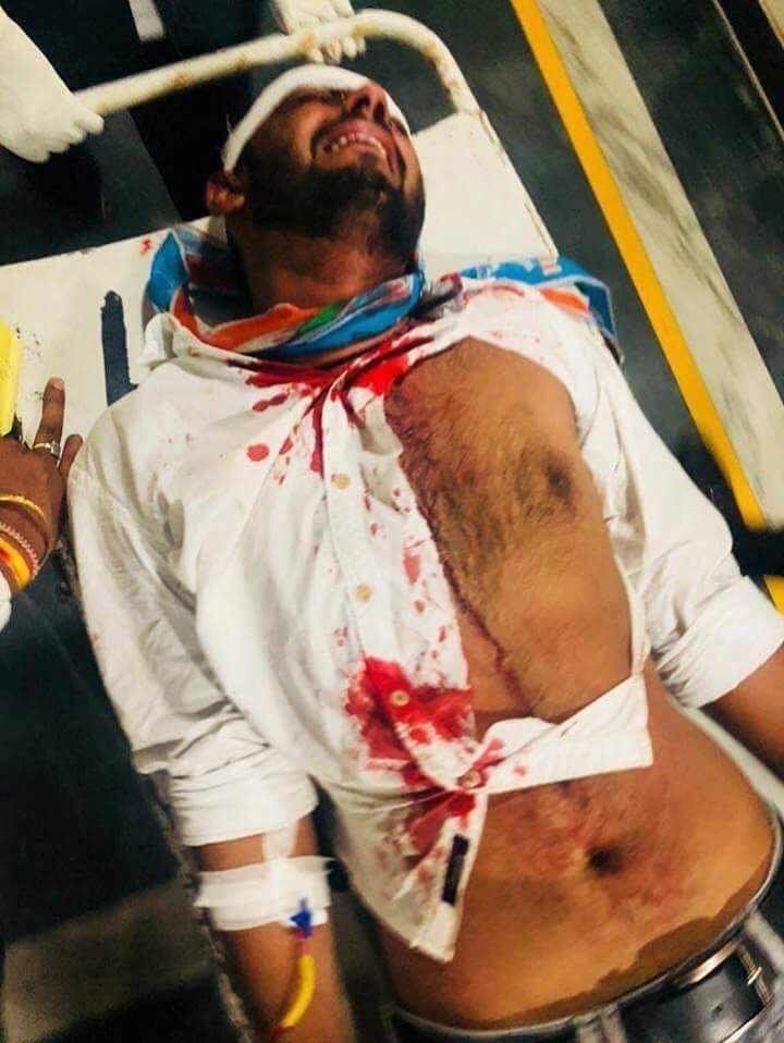 Sourabhmandloi7's tweet photo. NSUI राजस्थान के प्प्रदेशाध्यक्ष अभिमन्यू पूनिया और राजस्थान विश्वविद्यालय छात्रसंघ अध्यक्ष् प्रत्याक्षी रणवीर सिंघानिया पर बोखलाए हुये विरोधियो द्वारा गत रात हमला करना निंदनीय कृत्य है इसका जवाब राजस्थान विश्वविद्यालय का छात्र Nsui को जीताकर देगा । @AbhimanyuPooni5 #TackbackRu https://t.co/TlclAMw6Ew
