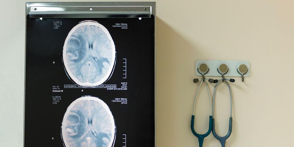 conectapaciente's tweet image. #Epilepsia en Acción! Así se llama el nuevo #proyecto que han puesto en marcha siete sociedades científicas, con el fin de dar a conocer esta #enfermedad y mejorar su situación en nuestro #país. Conoce los seis retos y prioridades de este proyecto.✅
bit.ly/6-retos-para-a…