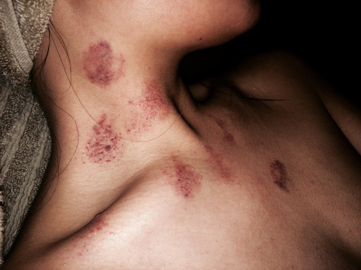 ✨aesthetics of the body (@smotriaaaaa) on Twitter photo 