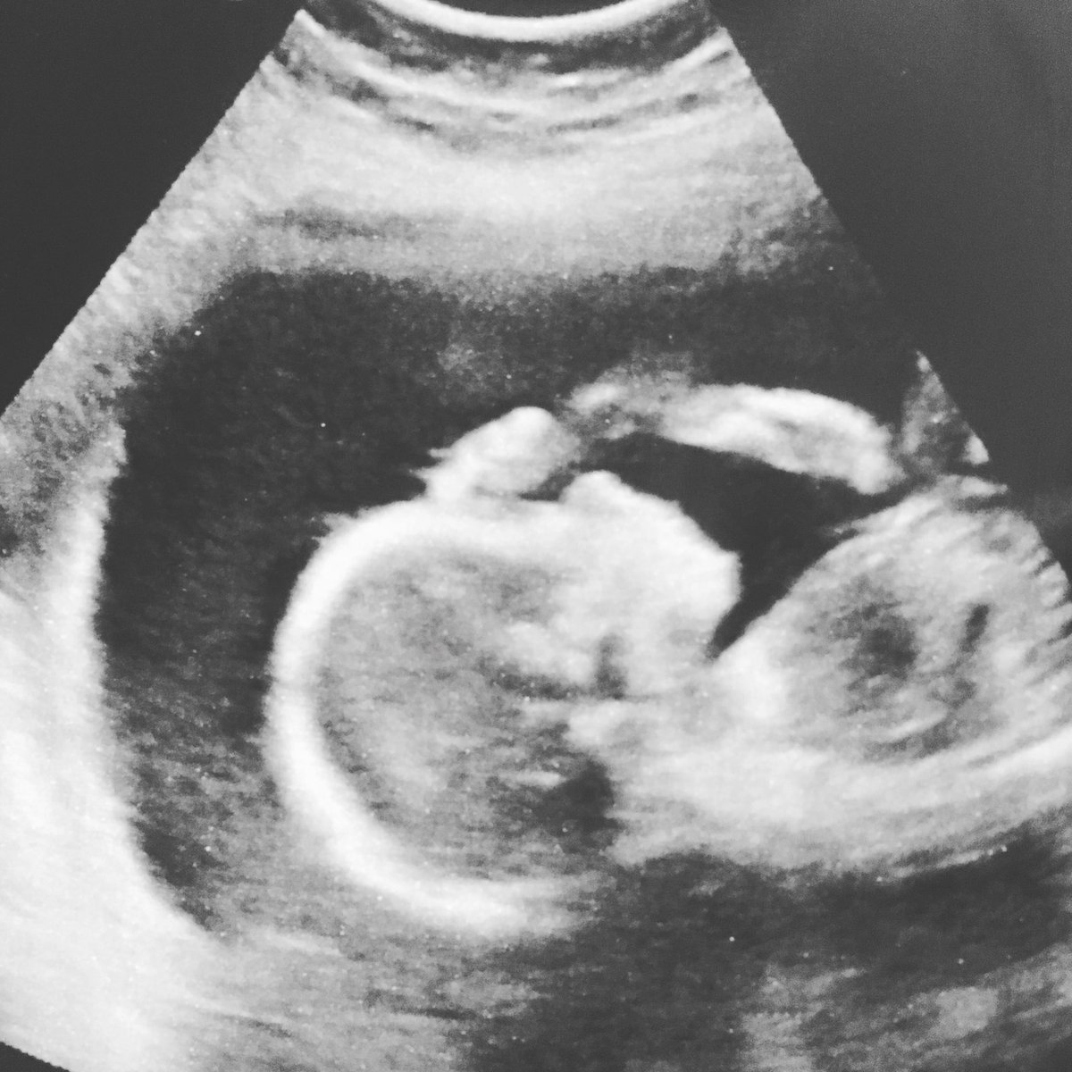 DanLeeMusic's tweet photo. Can we take a moment and talk about how cute my son is? This is his reaction...I’m embarrassing him already 😂 #pregnant #CarterLee #ultrasound https://t.co/eii8F4GYu5