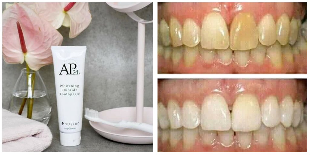 OverflowingB's tweet photo. Do your teeth know about AP24? The transformational toothpaste that has taken teeth whitening to a new level!

Need more details? Join our Facebook Group: https://t.co/EVOGw2cIyE …

#BeautyFair #beauty #teeth #teethwhitening #transformation #selfconfidence #Smile https://t.co/SpoP9AOYLU