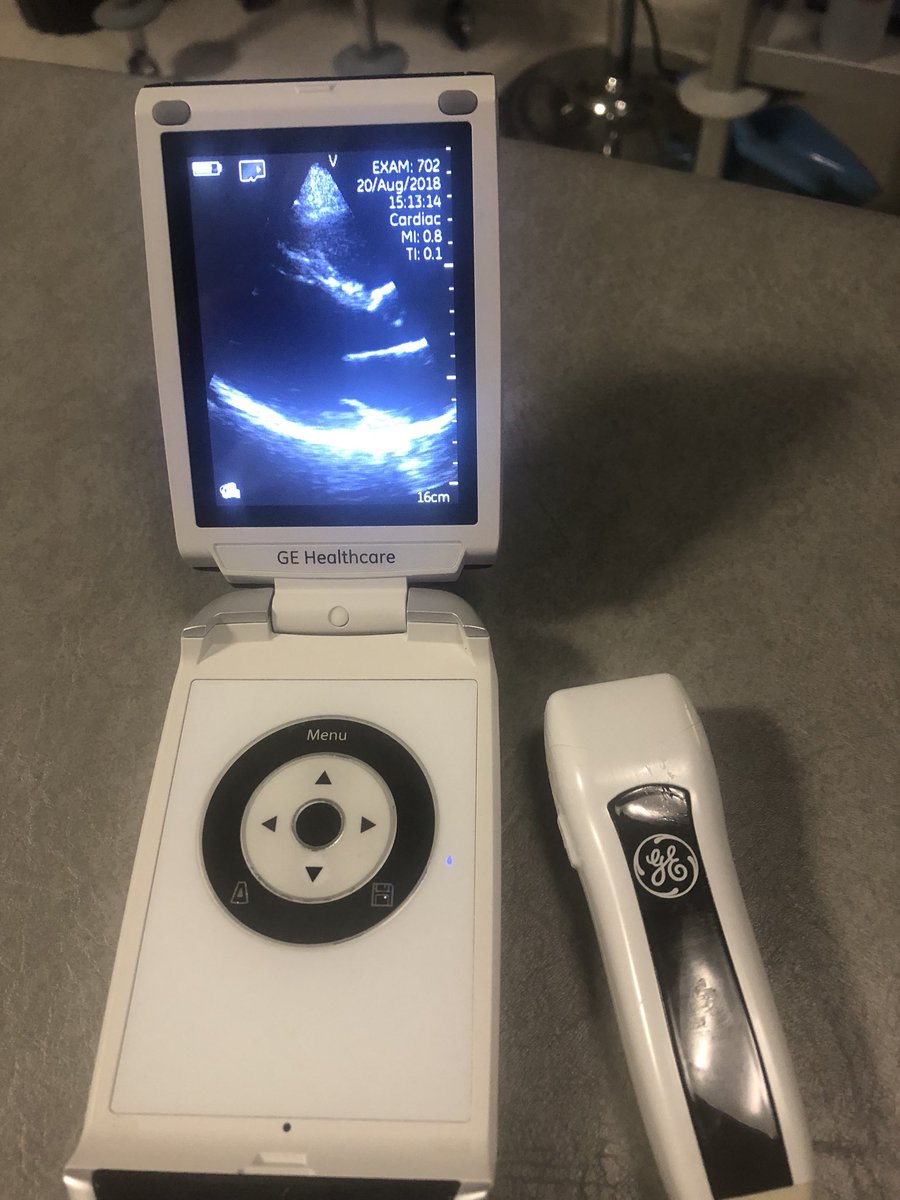 Having fun with the handheld Echo scanner! #GEhealthcare #heart #scannedmyself