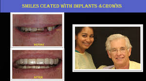 arrowheadpros's tweet photo. Never say never to dental care visit: The expert Prosthodontist in Phoenix, AZ at Arrowhead dental clinic offers the top advice to patients suffering from various dental issues. https://t.co/1rTMJpbfxS
