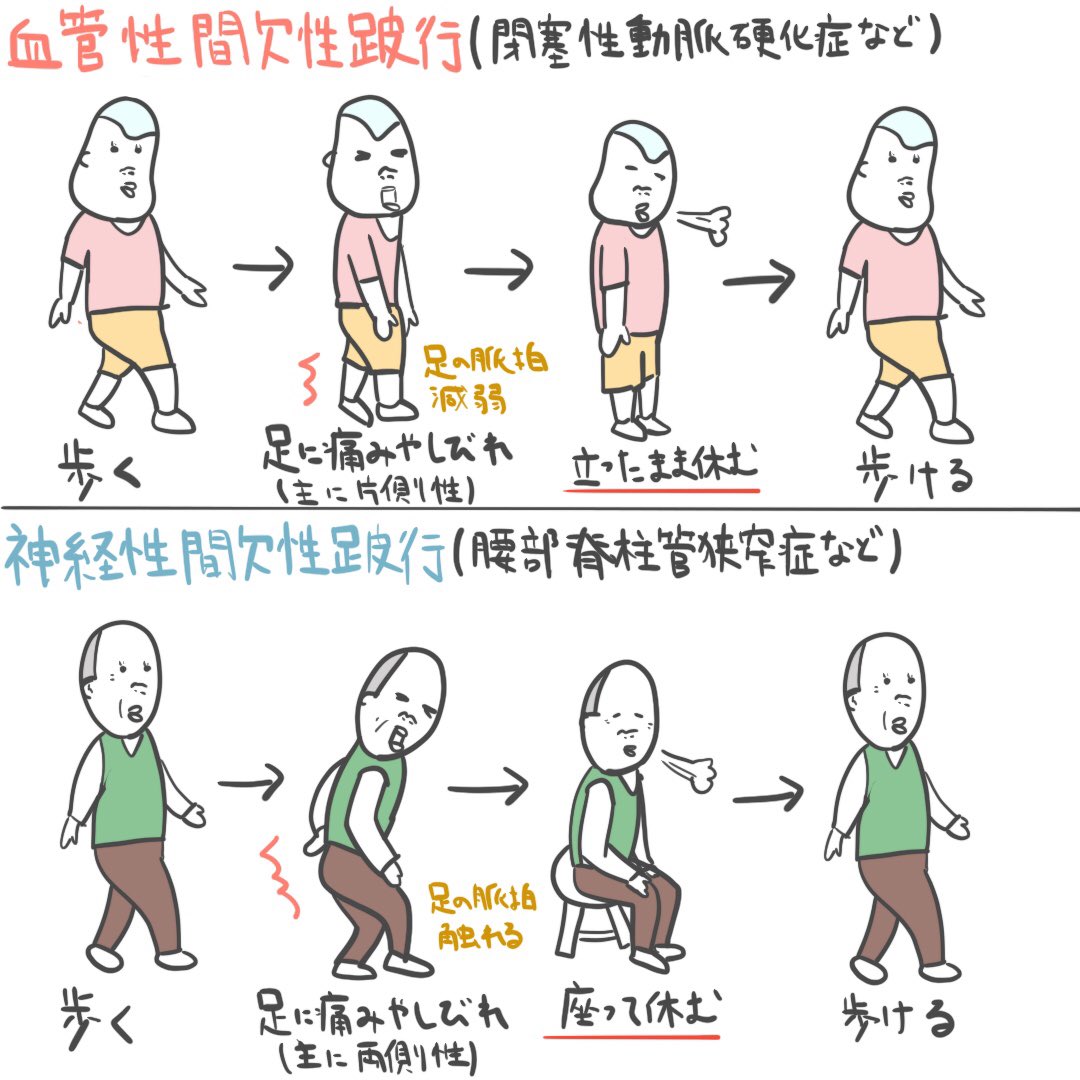 ゴロ 解剖生理イラスト 2コマで分かる 間欠性跛行 閉塞性動脈硬化症 腰部脊柱管狭窄症の 間欠性跛行の違い