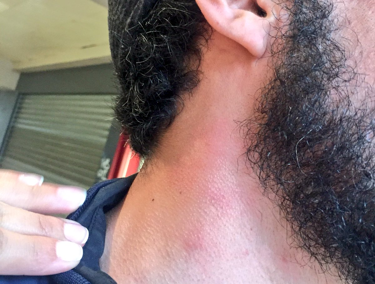 AnderssonBoscan's tweet photo. Puñeteado en Bélgica 🇧🇪. 
Vamos @MashiRafael debes de tener  un mecanismo de defensa menos mafioso. https://t.co/ChqK6C5VHu