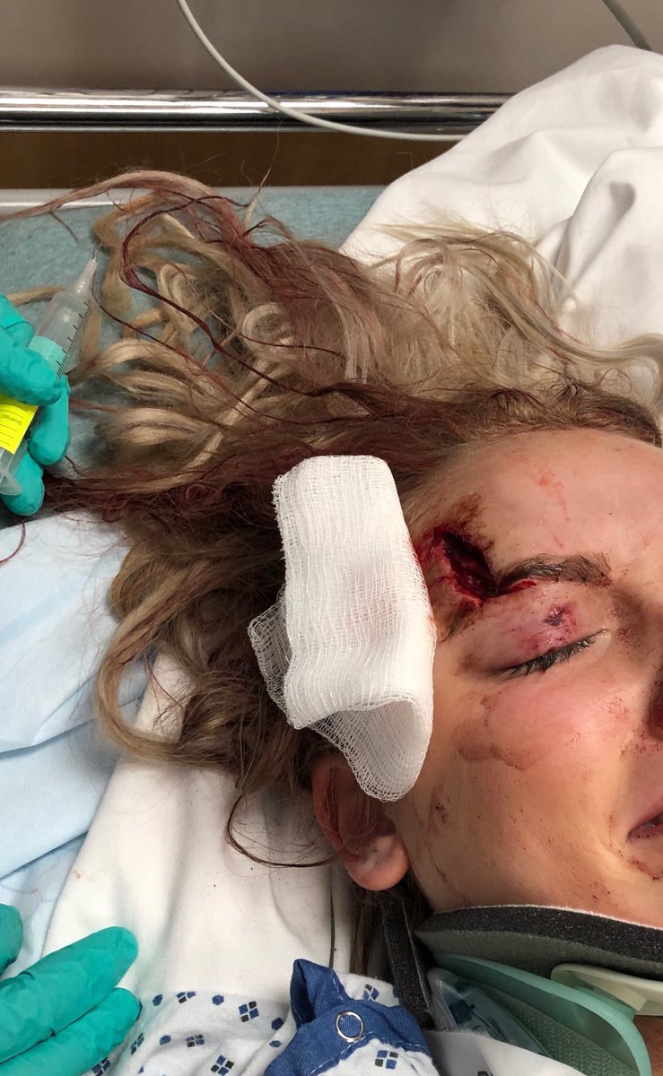 Hey @GEAZYNEWS <a href="/LILUZIVERT/">Uzi London 🌎☄️💕®</a>  wanna come see me since this happened to me on my way to see you???? ps sorry for slowing down traffic