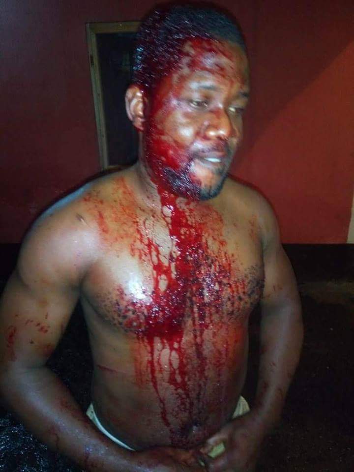 Journalist_Mind's tweet photo. @realAPCRivers Member Ichenwo Glory Was Attacked By PDP Thugs , This Nonsense Must Stop In Rivers State.
@DeeOneAyekooto @ijaola_ibrahim @ademolass @MrJoshuaSampson @Ayourb @Alphacube2000
#RiversByeElection #Nigeria #RiversDeservesRiverineGovernor #RiversState https://t.co/vgBMWqhR4T