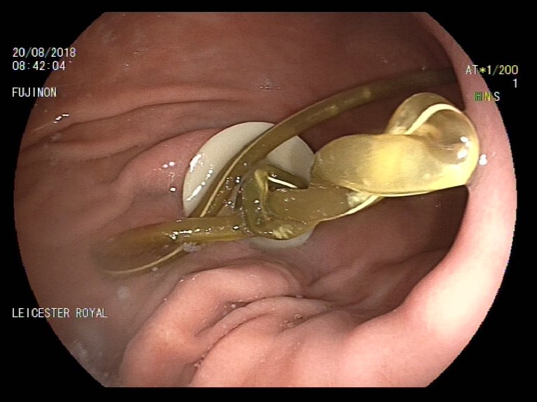 Leicnut's tweet photo. A knotty problem
#PEGJ https://t.co/tHJUREOXj3